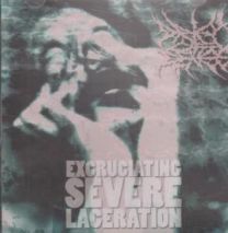 Excruciating Sever Laceration